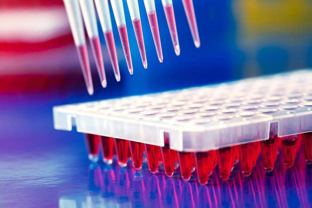 Blutimmunoassay-Test für Parasiten