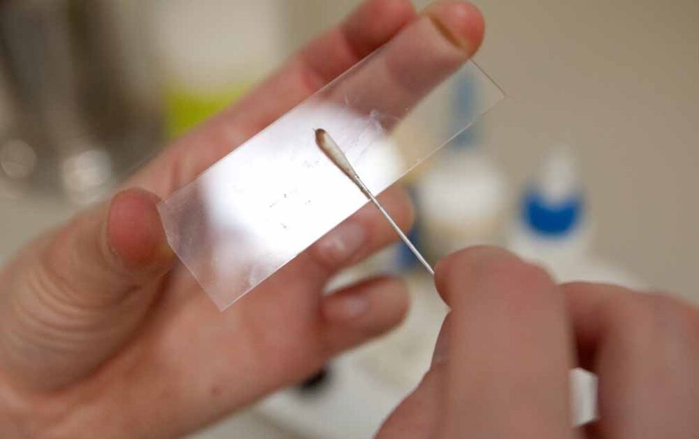 Kratzen auf das Vorhandensein von Parasiten im Körper
