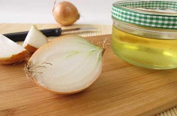 Zwiebelaufguss zur Entfernung von Würmern, eine Woche lang angewendet